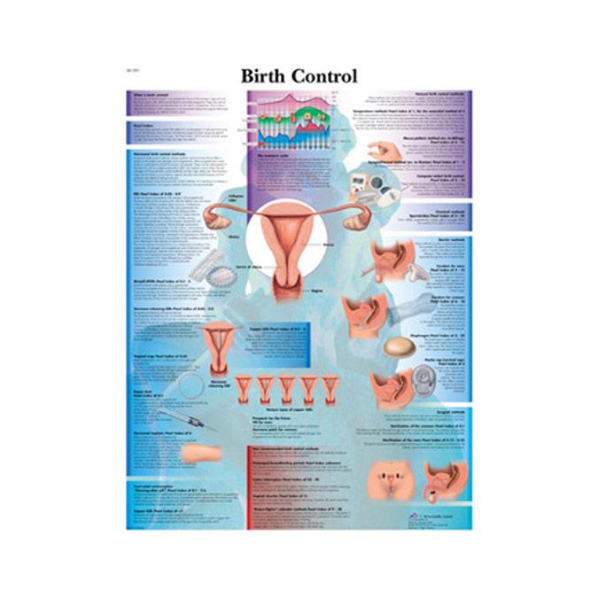 Birth Control Laminated Chart (French)